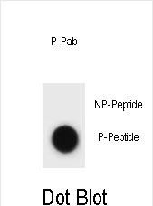 Dot blot analysis of mouse CCNB3 Antibody (Phospho T257) Phospho-specific Pab (Cat. #AP3809a) on nitrocellulose membrane. 50ng of Phospho-peptide or Non Phospho-peptide per dot were adsorbed. Antibody working concentrations are 0.6ug per ml.