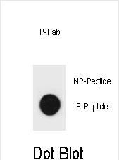 Dot blot analysis of mouse TSC2 Antibody (Phospho S1412) Phospho-specific Pab (Cat. #AP3826a) on nitrocellulose membrane. 50ng of Phospho-peptide or Non Phospho-peptide per dot were adsorbed. Antibody working concentrations are 0.6ug per ml.