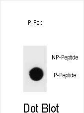 Dot blot analysis of rat TSC1 Antibody (Phospho T417) Phospho-specific Pab (Cat. #AP3831a) on nitrocellulose membrane. 50ng of Phospho-peptide or Non Phospho-peptide per dot were adsorbed. Antibody working concentrations are 0.6ug per ml.
