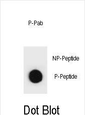 Dot blot analysis of rat TSC2 Antibody (Phospho T1373) Phospho-specific Pab (Cat. #AP3833a) on nitrocellulose membrane. 50ng of Phospho-peptide or Non Phospho-peptide per dot were adsorbed. Antibody working concentrations are 0.6ug per ml.