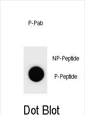 Dot blot analysis of Mouse CCNB3 Antibody (Phospho S1063) Phospho-specific Pab (Cat. #AP3872a) on nitrocellulose membrane. 50ng of Phospho-peptide or Non Phospho-peptide per dot were adsorbed. Antibody working concentrations are 0.6ug per ml.