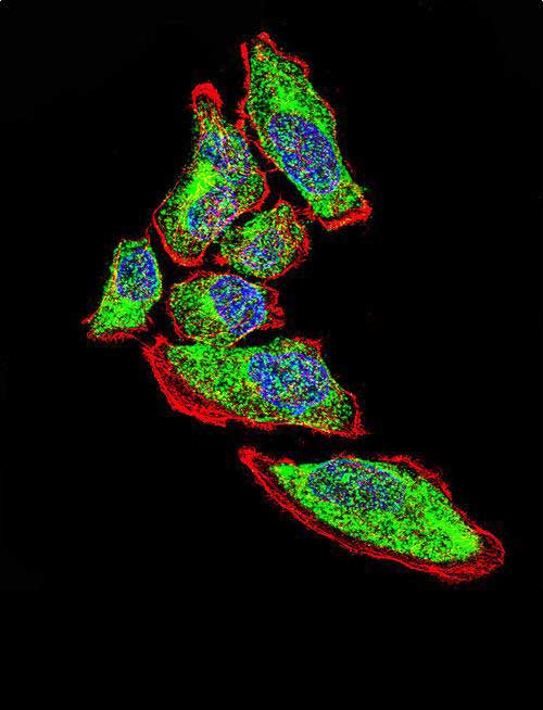Confocal immunofluorescent analysis of Vimentin Antibody with A549 cell followed by Alexa Fluor 488-conjugated goat anti-rabbit lgG (green). Actin filaments have been labeled with Alexa Fluor 555 phalloidin (red). DAPI was used to stain the cell nuclear (blue).