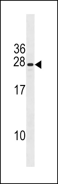 WB - CXorf41 Antibody (C-term) AP20291b