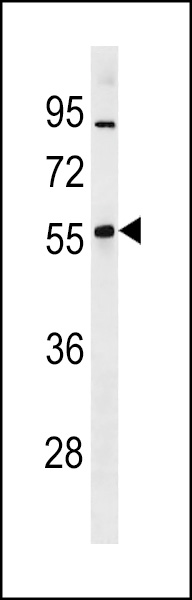 Mouse Znf260 Antibody (N-term) (Cat. #AP20301a) western blot analysis in mouse lung tissue lysates (35ug/lane).This demonstrates the Mouse Znf260 antibody detected the Mouse Znf260 protein (arrow).