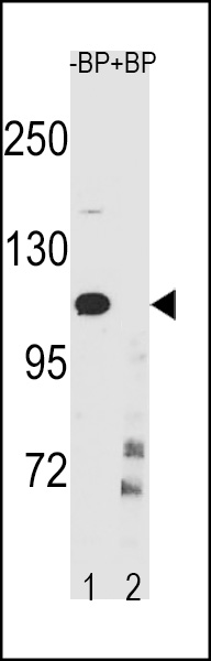 IKKB Antibody (Center Y609) (Cat. #AP20326c) western blot analysis in CEM cell line lysates (35ug/lane).This demonstrates the IKKB antibody detected the IKKB protein (arrow).