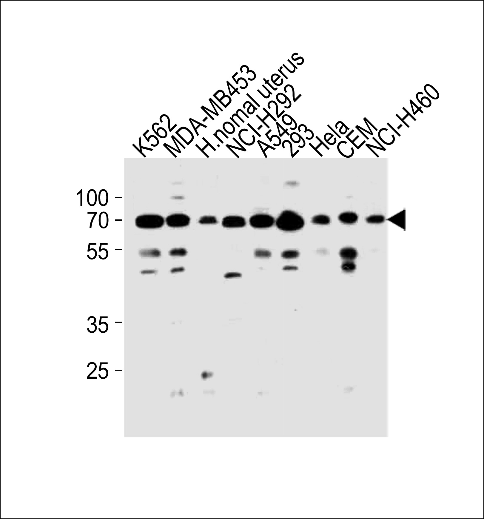 PARP3 Antibody (N-term) (Cat. #AP20360a) western blot analysis in K562,MDA-MB453,NCI-H292,A549,293,Hela,CEM,NCI-H460 cell line and human nomal uterus tissue lysates (35ug/lane).This demonstrates the PARP3 antibody detected the PARP3 protein (arrow).