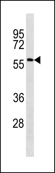 ACSF2 Antibody (C-term) (Cat. #AP20368b) western blot analysis in Jurkat cell line lysates (35ug/lane).This demonstrates the ACSF2 antibody detected the ACSF2 protein (arrow).