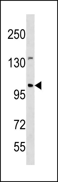 WB - ESCO1 Antibody (C-term) AP20370b