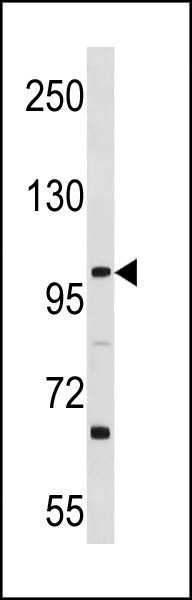 WB - L3MBTL3 Antibody (N-term) AP20376a