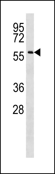 WB - CCDC155 Antibody (Center) AP20386c