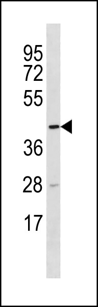 WB - TTC5 Antibody (C-term) AP20388b