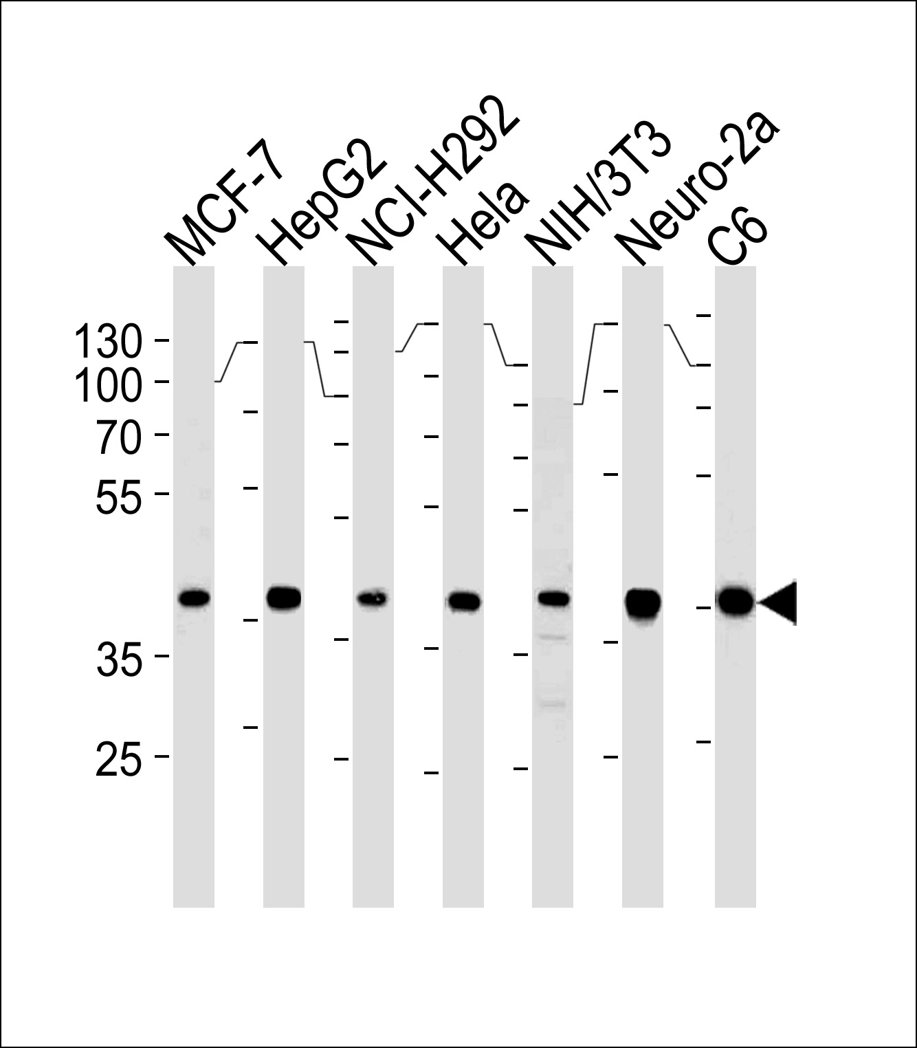 WB - Erk2 Monoclonal Antibody [Knockout Validated] AW5701-U100