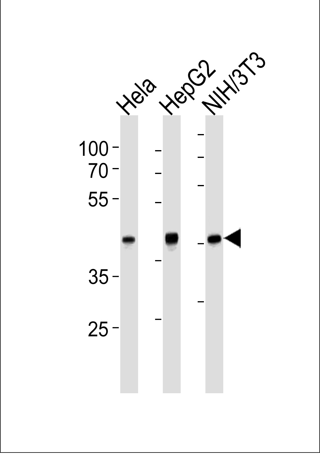 TBP Antibody (Cat. #AM2196b) western blot analysis in Hela,HepG2,mouse NIH/3T3 cell line lysates (35?g/lane).This demonstrates the TBP antibody detected the TBP protein (arrow).