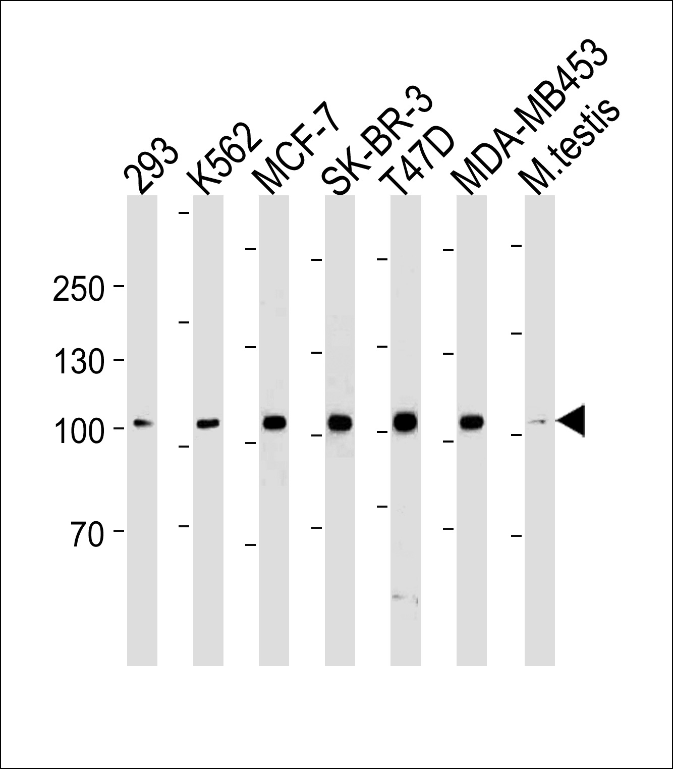 ACE2 (SARS Receptor) Antibody (Center) (Cat. #AM2197b) western blot analysis in 293,K562,MCF-7,SK-BR-3,T47D,MDA-MB-453 cell line and mouse testis tissue lysates (35?g/lane).This demonstrates the ACE2 antibody detected the ACE2 protein (arrow).