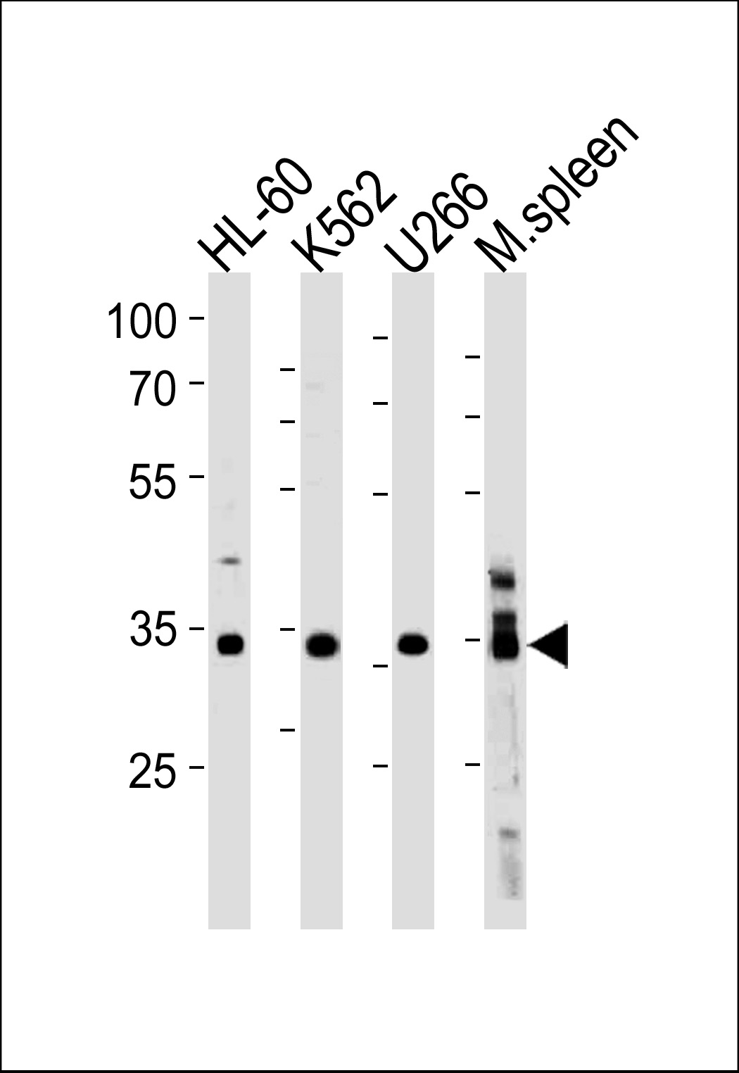 GFI1B Antibody (C-term) (Cat. #AP20437b) western blot analysis in HL-60,K562,U266 cell line and mouse spleen lysates (35ug/lane).This demonstrates the GFI1B antibody detected the GFI1B protein (arrow).