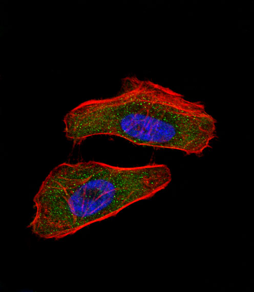Fluorescent confocal image of Hela cell stained with HIF1A Antibody (N-term)(Cat#AP4776a). Hela cells were fixed with 4% PFA (20 min), permeabilized with Triton X-100 (0.1%, 10 min), then incubated with HIF1A primary antibody (1:25, 1 h at 37?). For secondary antibody, Alexa Fluor� 488 conjugated donkey anti-rabbit antibody (green) was used (1:400, 50 min at 37?).Cytoplasmic actin was counterstained with Alexa Fluor� 555 (red) conjugated Phalloidin (7units/ml, 1 h at 37?). Nuclei were counterstained with DAPI (blue) (10 �g/ml, 10 min).HIF1A immunoreactivity is localized to cytoplasm and nucleus significantly.