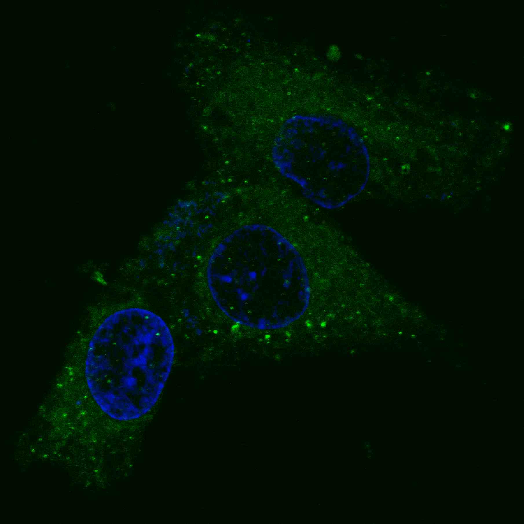 Fluorescent confocal image of HepG2 cells stained with MET/HGFR antibody. HepG2 cells were fixed with 4% PFA (20 min), permeabilized with Triton X-100 (0.2%, 30 min). Cells were then incubated with AM1001a MET/HGFR primary antibody (1:100, 2 h at room temperature). For secondary antibody, Alexa Fluor® 488 conjugated donkey anti-mouse antibody (green) was used (1:1000, 1h). Nuclei were counterstained with Hoechst 33342 (blue) (10 μg/ml, 5 min). Note the highly specific localization of the MET immunosignal to the cytoplasm, supported by Human Protein Atlas Data (http://www.proteinatlas.org/ENSG00000105976).