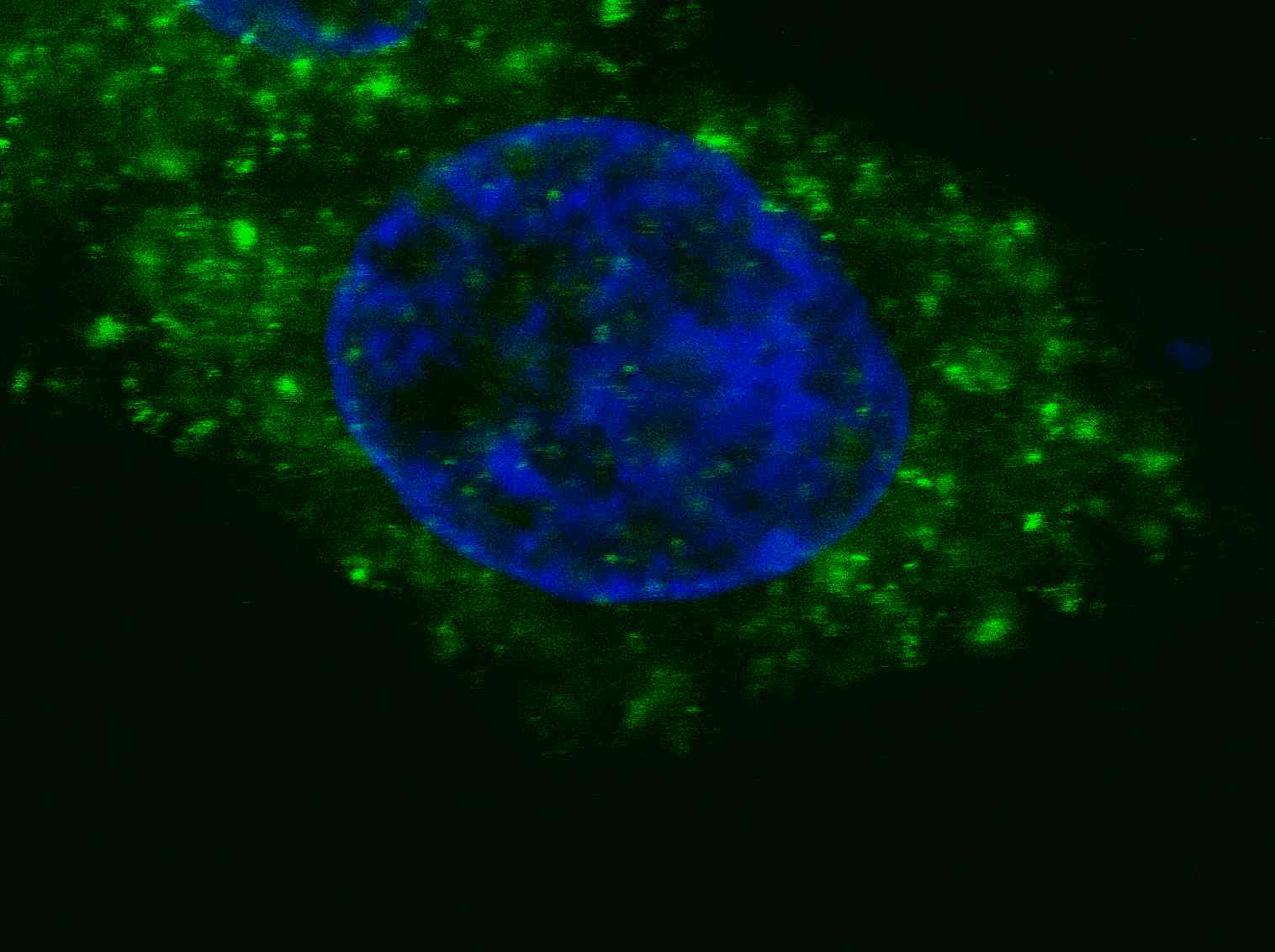 Fluorescent confocal image of HepG2 cells stained with MET/HGFR antibody. HepG2 cells were fixed with 4% PFA (20 min), permeabilized with Triton X-100 (0.2%, 30 min). Cells were then incubated with AM1003a MET/HGFR primary antibody (1:200, 2 h at room temperature). For secondary antibody, Alexa Fluor® 488 conjugated donkey anti-mouse antibody (green) was used (1:1000, 1h). Nuclei were counterstained with Hoechst 33342 (blue) (10 μg/ml, 5 min). Note the highly specific localization of the MET immunosignal to the cytoplasm, supported by Human Protein Atlas Data (http://www.proteinatlas.org/ENSG00000105976).