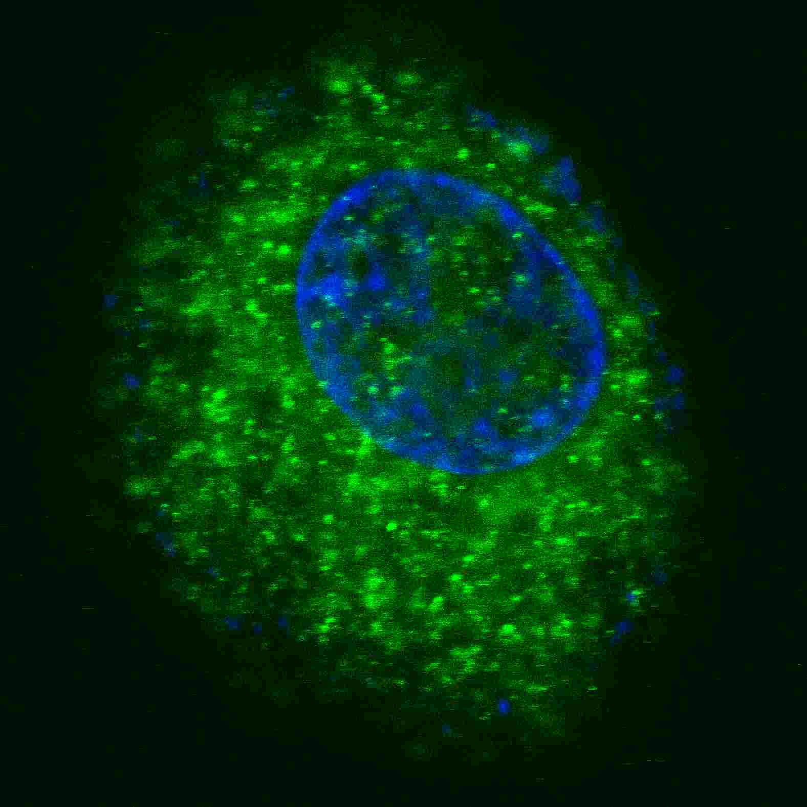 Fluorescent confocal image of HepG2 cells stained with MET/HGFR antibody. HepG2 cells were fixed with 4% PFA (20 min), permeabilized with Triton X-100 (0.2%, 30 min). Cells were then incubated with AM1004a MET/HGFR primary antibody (1:200, 2 h at room temperature). For secondary antibody, Alexa Fluor® 488 conjugated donkey anti-mouse antibody (green) was used (1:1000, 1h). Nuclei were counterstained with Hoechst 33342 (blue) (10 μg/ml, 5 min). Note the highly specific localization of the MET immunosignal to the cytoplasm, supported by Human Protein Atlas Data (http://www.proteinatlas.org/ENSG00000105976).