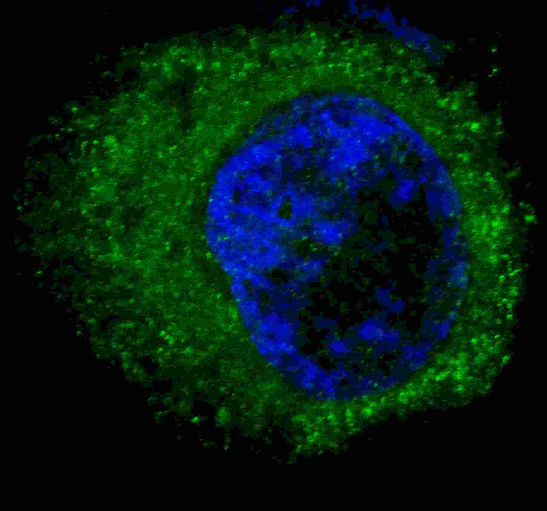 Fluorescent confocal image of HepG2 cells stained with MET/HGFR antibody. HepG2 cells were fixed with 4% PFA (20 min), permeabilized with Triton X-100 (0.2%, 30 min). Cells were then incubated with AM1005a MET/HGFR primary antibody (1:100, 2 h at room temperature). For secondary antibody, Alexa Fluor® 488 conjugated donkey anti-mouse antibody (green) was used (1:1000, 1h). Nuclei were counterstained with Hoechst 33342 (blue) (10 μg/ml, 5 min). Note the highly specific localization of the MET immunosignal to the cytoplasm, supported by Human Protein Atlas Data (http://www.proteinatlas.org/ENSG00000105976).