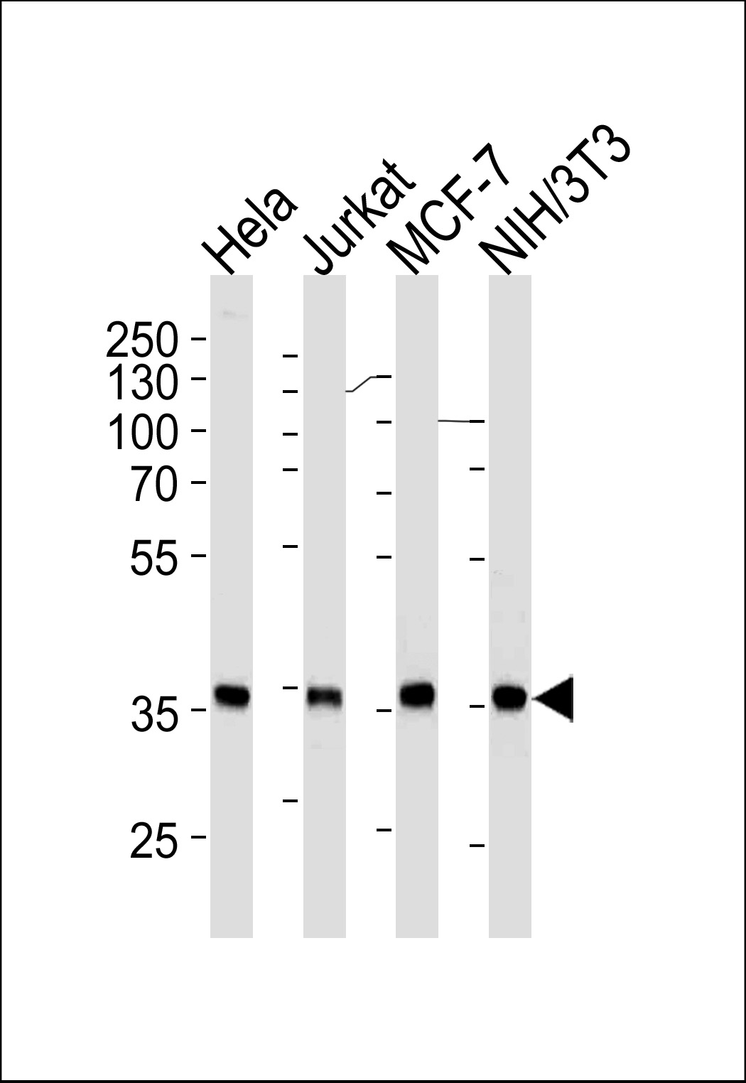 NPM1 Antibody (Cat. #AM2201b) western blot analysis in Hela,Jurkat,MCF-7,mouse NIH/3T3 cell line lysates (35?g/lane).This demonstrates the NPM1 antibody detected the NPM1 protein (arrow).