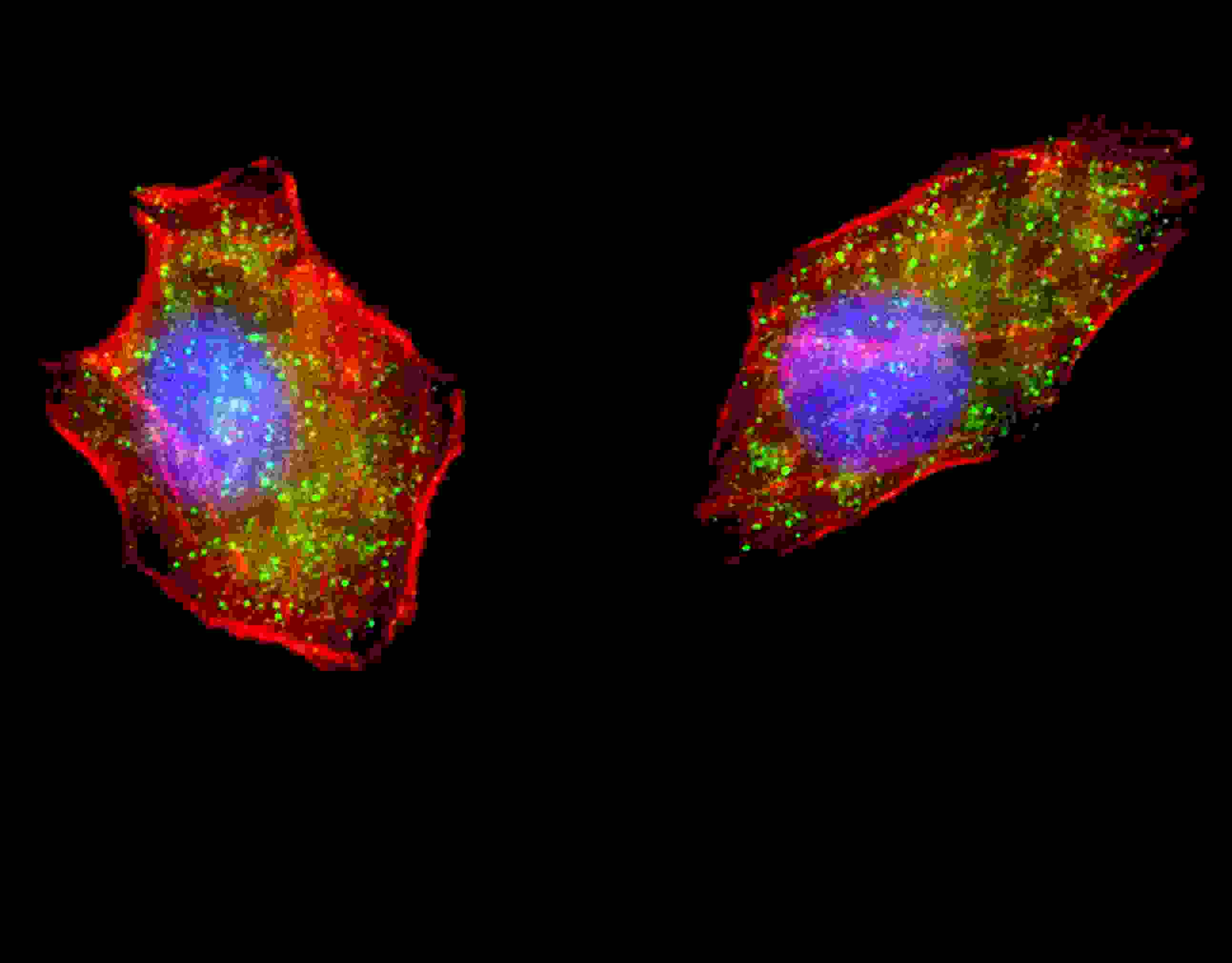 Fluorescent image of U251 cells stained with ATG4D (N-term) antibody. U251 cells were treated with Chloroquine (50 ?M,16h), then fixed with 4% PFA (20 min), permeabilized with Triton X-100 (0.2%, 30 min). Cells were then incubated with AP11448a ATG4D (N-term) primary antibody (1:200, 2 h at room temperature). For secondary antibody, Alexa Fluor� 488 conjugated donkey anti-rabbit antibody (green) was used (1:1000, 1h). Cytoplasmic actin was counterstained with Alexa Fluor� 555 (red) conjugated Phalloidin (5.25 ?M, 25 min). Nuclei were counterstained with Hoechst 33342 (blue) (10 ?g/ml, 5 min). Pictures were taken on a Biorevo microscope (BZ-900, Keyence). ATG4D (N-term) immunoreactivity is localized to autophagic vacuoles in the cytoplasm of U251 cells. 