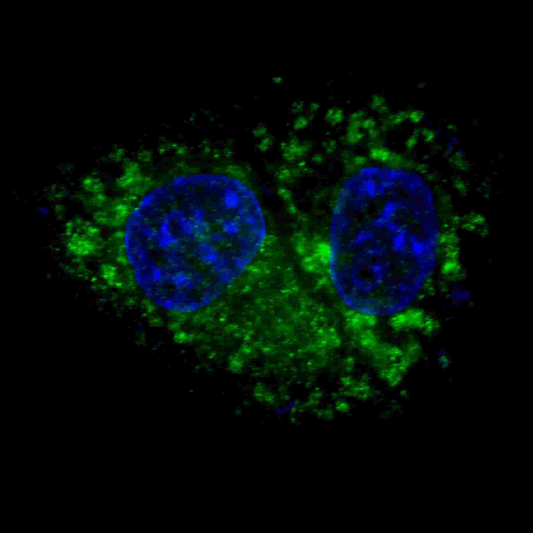 Fluorescent confocal image of HepG2 cells stained with ALDH1A1 antibody. HepG2 cells were fixed with 4% PFA (20 min), permeabilized with Triton X-100 (0.2%, 30 min). Cells were then incubated with AP1465d ALDH1A1 primary antibody (1:100, 2 h at room temperature). For secondary antibody, Alexa Fluor� 488 conjugated donkey anti-rabbit antibody (green) was used (1:1000, 1h). Nuclei were counterstained with Hoechst 33342 (blue) (10 ?g/ml, 5 min). ALDH1A1 immunoreactivity is localized to the cytoplasm of HepG2 cells.