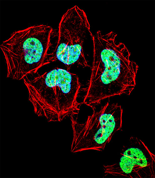 Fluorescent confocal image of Hela cell stained with ZNF155 Antibody (C-term)(Cat#AP16962b).Hela cells were fixed with 4% PFA (20 min), permeabilized with Triton X-100 (0.1%, 10 min), then incubated with ZNF155 primary antibody (1:25, 1 h at 37?). For secondary antibody, Alexa Fluor� 488 conjugated donkey anti-rabbit antibody (green) was used (1:400, 50 min at 37?).Cytoplasmic actin was counterstained with Alexa Fluor� 555 (red) conjugated Phalloidin (7units/ml, 1 h at 37?). Nuclei were counterstained with DAPI (blue) (10 �g/ml, 10 min). ZNF155 immunoreactivity is localized to Nucleus significantly.
