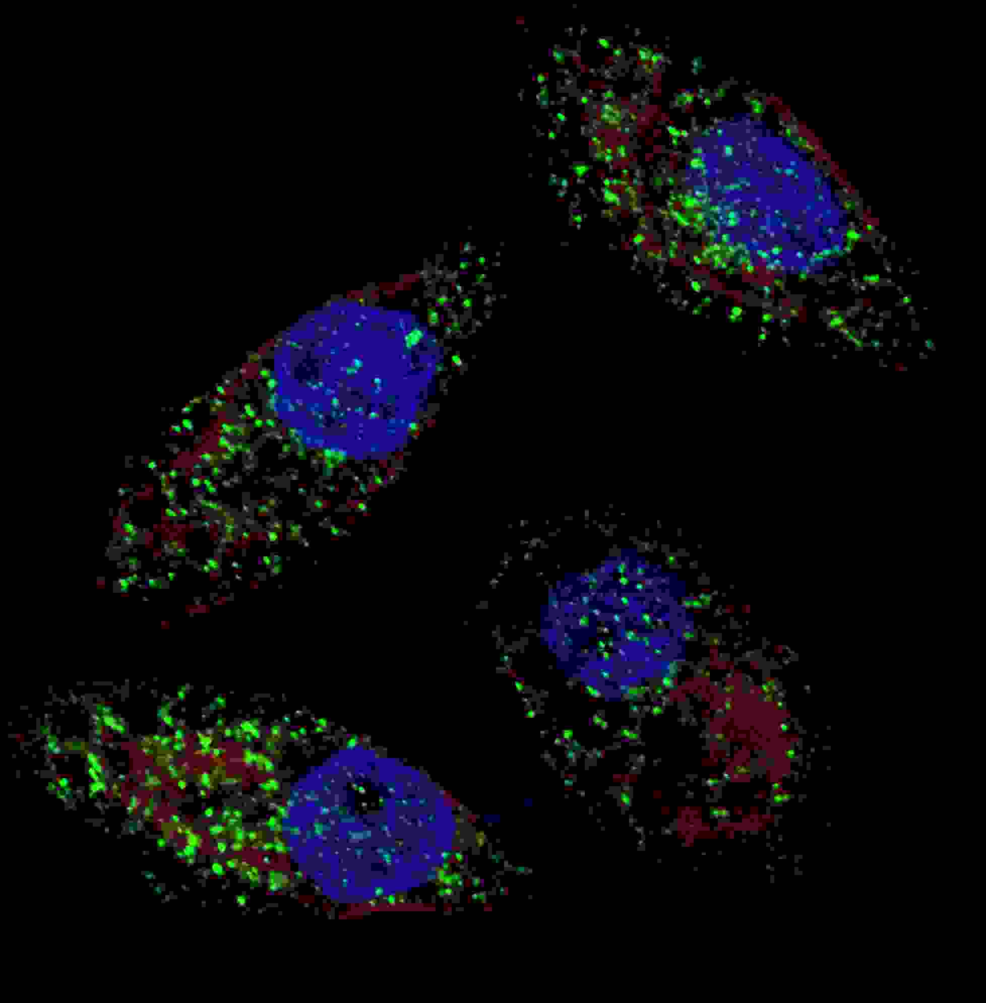 Fluorescent image of U251 cells stained  with cleaved LC3B antibody. U251 cells were treated with Chloroquine (50 ?M,16h), then fixed with 4% PFA (20 min), permeabilized with Triton X-100 (0.2%, 30 min). Cells were then incubated with AP1806a cleaved LC3B primary antibody (1:100, 2 h at room temperature). For secondary antibody, Alexa Fluor� 488 conjugated donkey anti-rabbit antibody (green) was used (1:1000, 1h). Nuclei were counterstained with Hoechst 33342 (blue) (10 ?g/ml, 5 min). LC3 immunoreactivity is localized to autophagic vacuoles in the cytoplasm of U251 cells.