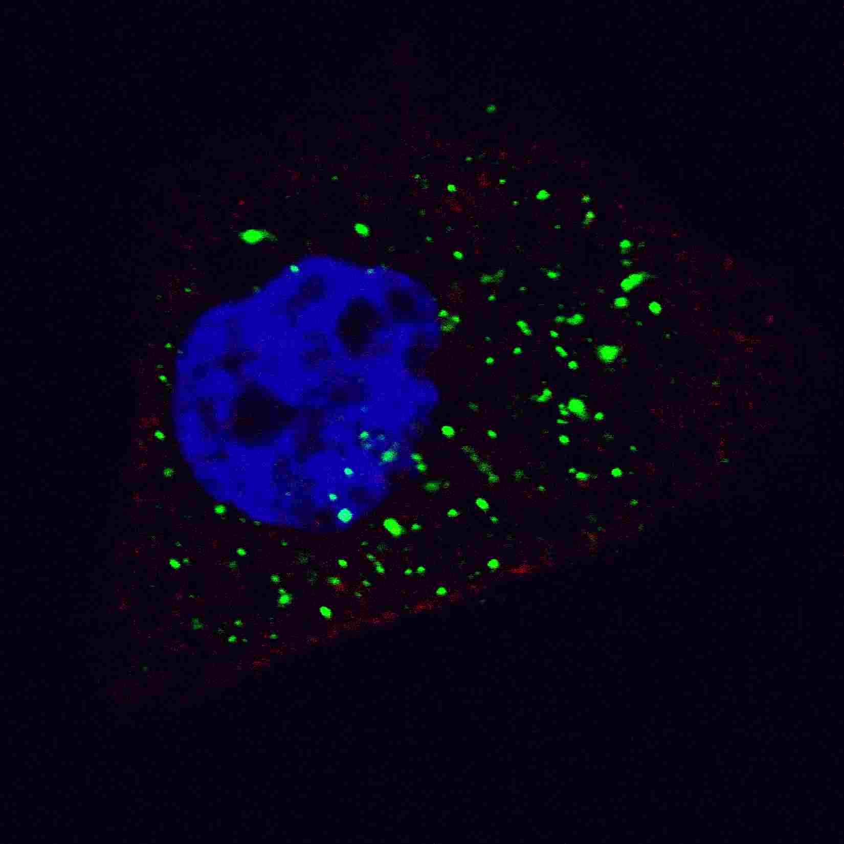 Fluorescent image of U251 cells stained with ATG4B (C-term) antibody. U251 cells were treated with Chloroquine (50 ?M,16h), then fixed with 4% PFA (20 min), permeabilized with Triton X-100 (0.2%, 30 min). Cells were then incubated with AP1809c ATG4B (C-term) primary antibody (1:100, 2 h at room temperature). For secondary antibody, Alexa Fluor� 488 conjugated donkey anti-rabbit antibody (green) was used (1:1000, 1h). Nuclei were counterstained with Hoechst 33342 (blue) (10 ?g/ml, 5 min). ATG4B immunoreactivity is localized to autophagic vacuoles in the cytoplasm of U251 cells.