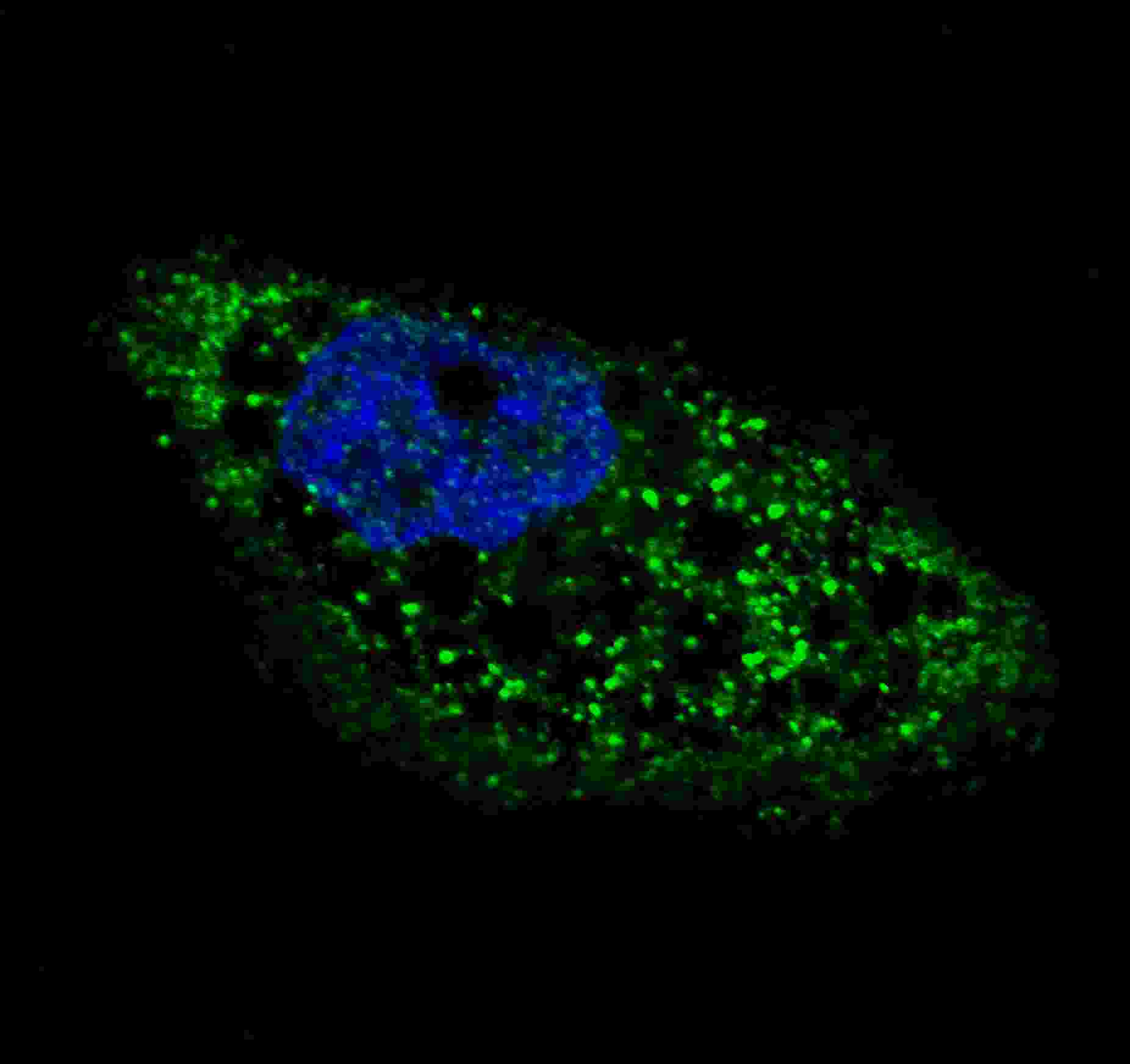Fluorescent image of U251 cells stained with ATG4D (C-term) antibody. U251 cells were treated with Chloroquine (50 ?M,16h), then fixed with 4% PFA (20 min), permeabilized with Triton X-100 (0.2%, 30 min). Cells were then incubated with AP1811c ATG4D (C-term) primary antibody (1:100, 2 h at room temperature). For secondary antibody, Alexa Fluor� 488 conjugated donkey anti-rabbit antibody (green) was used (1:1000, 1h). Nuclei were counterstained with Hoechst 33342 (blue) (10 ?g/ml, 5 min). ATG4D immunoreactivity is localized to autophagic vacuoles in the cytoplasm of U251 cells.