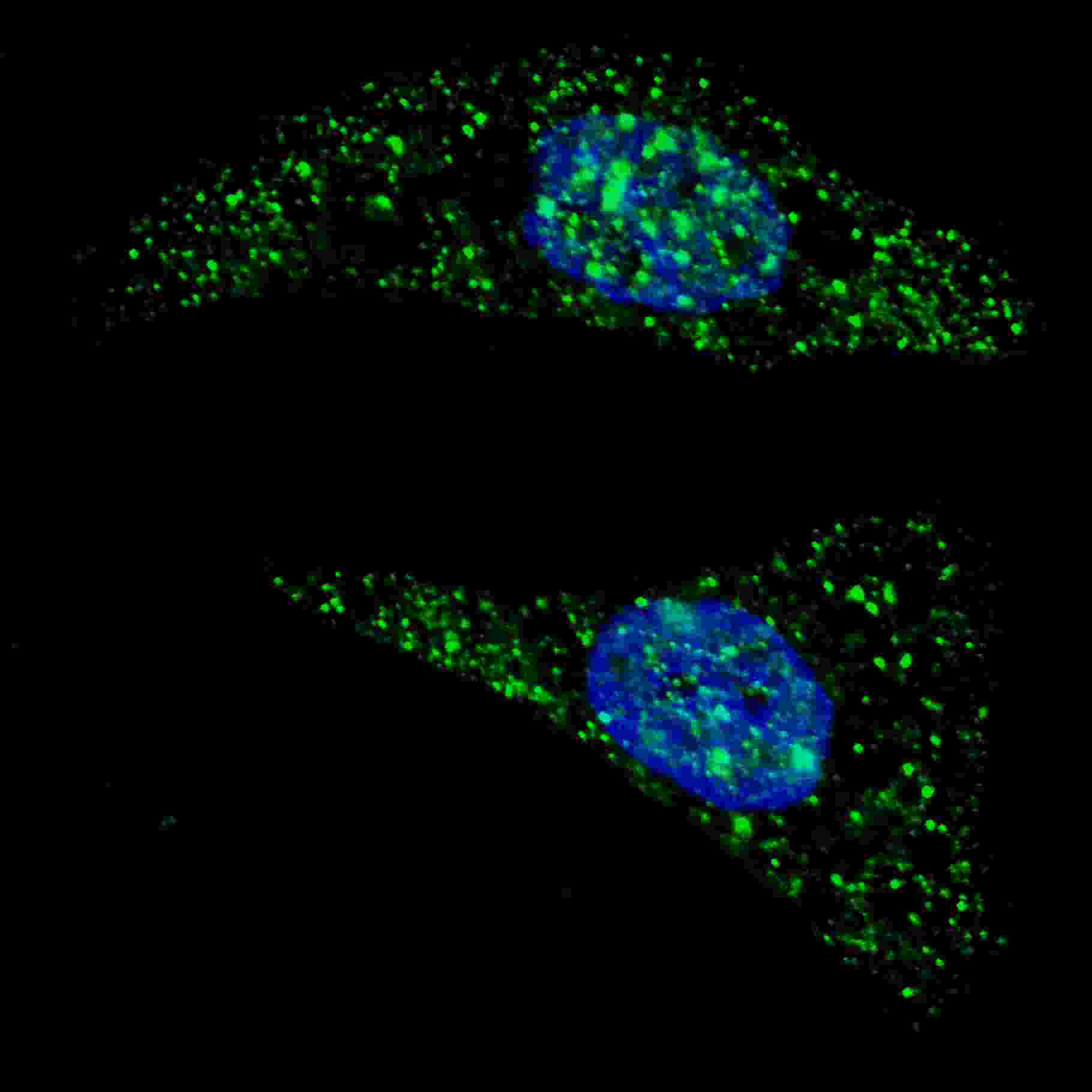 Fluorescent image of U251 cells stained with ATG5 (N-term) antibody. U251 cells were treated with Chloroquine (50 ?M,16h), then fixed with 4% PFA (20 min), permeabilized with Triton X-100 (0.2%, 30 min). Cells were then incubated with AP1812a ATG5 (N-term) primary antibody (1:200, 2 h at room temperature). For secondary antibody, Alexa Fluor� 488 conjugated donkey anti-rabbit antibody (green) was used (1:1000, 1h). Nuclei were counterstained with Hoechst 33342 (blue) (10 ?g/ml, 5 min). ATG5 immunoreactivity is localized to autophagic vacuoles in the cytoplasm of U251 cells.