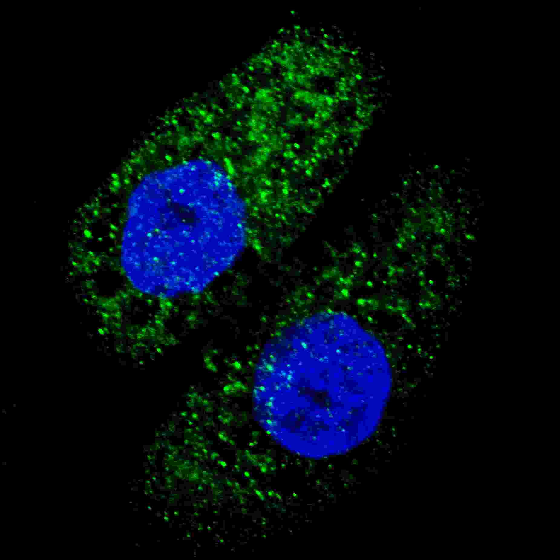 Fluorescent image of U251 cells stained with ATG5 antibody. U251 cells were treated with Chloroquine (50 ?M,16h), then fixed with 4% PFA (20 min), permeabilized with Triton X-100 (0.2%, 30 min). Cells were then incubated with AP1812c ATG5 primary antibody (1:200, 2 h at room temperature). For secondary antibody, Alexa Fluor� 488 conjugated donkey anti-rabbit antibody (green) was used (1:1000, 1h). Nuclei were counterstained with Hoechst 33342 (blue) (10 ?g/ml, 5 min). ATG5 immunoreactivity is localized to autophagic vacuoles in the cytoplasm of U251 cells.