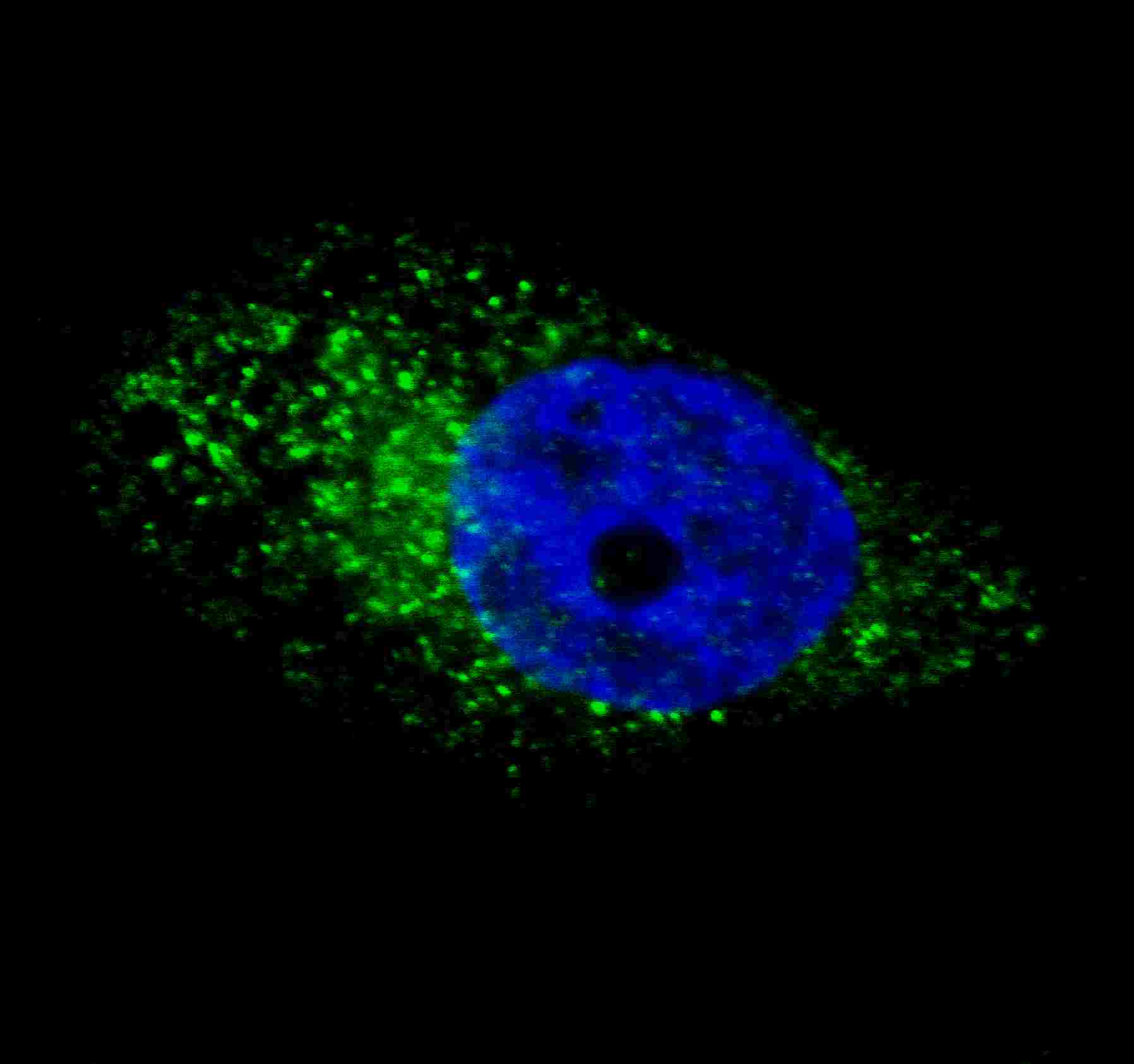 Fluorescent image of U251 cells stained with ATG16L antibody. U251 cells were treated with Chloroquine (50 ?M,16h), then fixed with 4% PFA (20 min), permeabilized with Triton X-100 (0.2%, 30 min). Cells were then incubated with AP1817d ATG16L primary antibody (1:100, 2 h at room temperature). For secondary antibody, Alexa Fluor� 488 conjugated donkey anti-rabbit antibody (green) was used (1:1000, 1h). Nuclei were counterstained with Hoechst 33342 (blue) (10 ?g/ml, 5 min). ATG16L immunoreactivity is localized to autophagic vacuoles in the cytoplasm of U251 cells, supported by Human Protein Atlas Data (http://www.proteinatlas.org/ENSG00000085978).