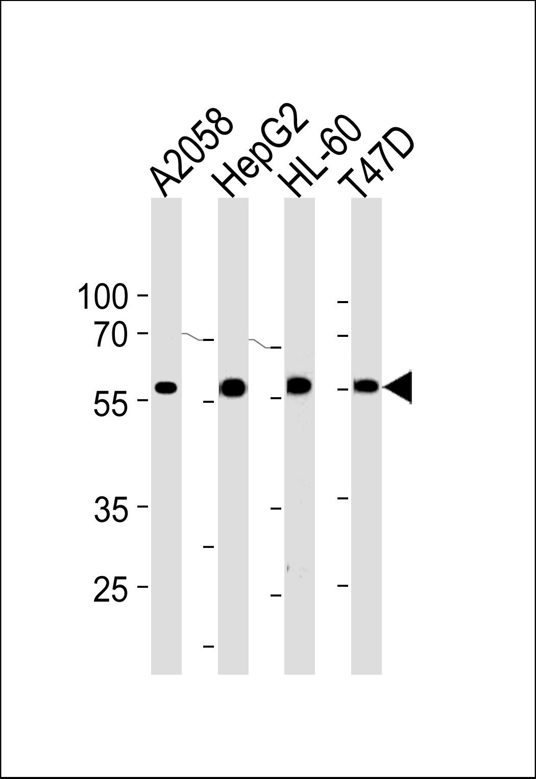 GRN Antibody (C-term) (Cat. #AP20450b) western blot analysis in A2058,HepG2,HL-60,T47D cell line lysates (35ug/lane).This demonstrates the GRN antibody detected the GRN protein (arrow).
