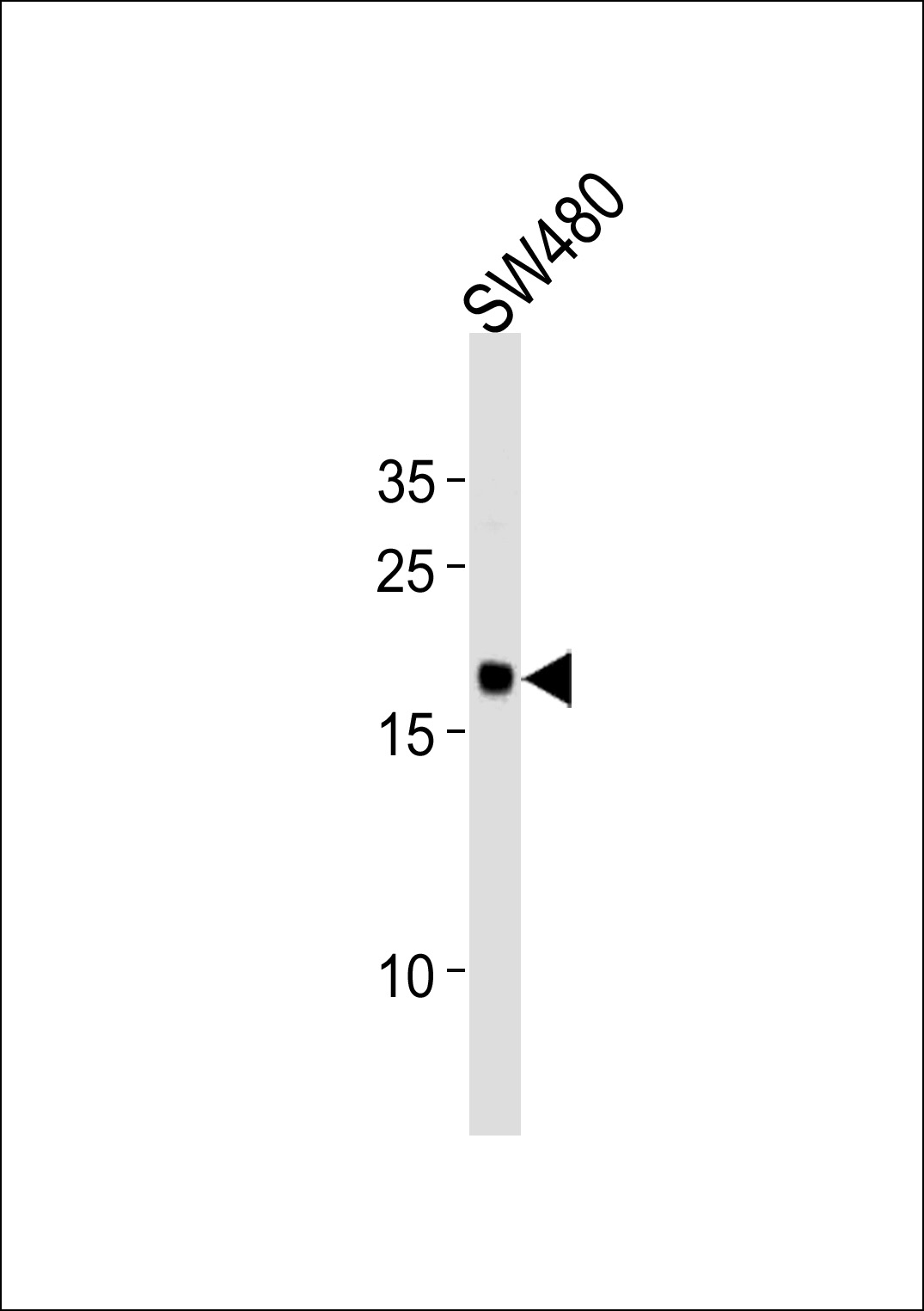 WB - RPL29 Antibody (Center) AP20452c
