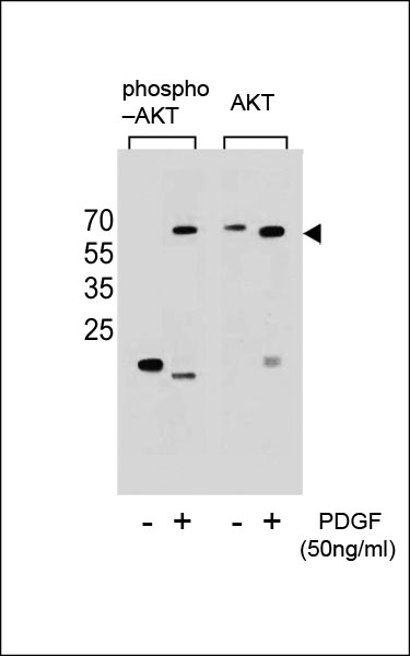 Western blot analysis of extracts from NIH-3T3 cells,untreated or treated with PDGF,using Phospho-Akt(Ser473)(left) or Akt antibody(right).