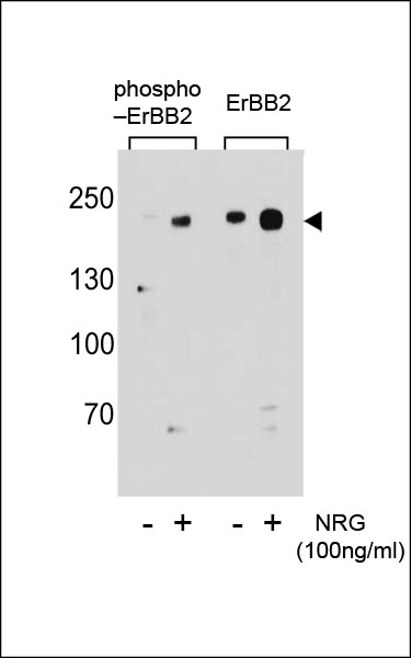 WB - Phospho-ERBB2(S1151) Antibody AP3781c