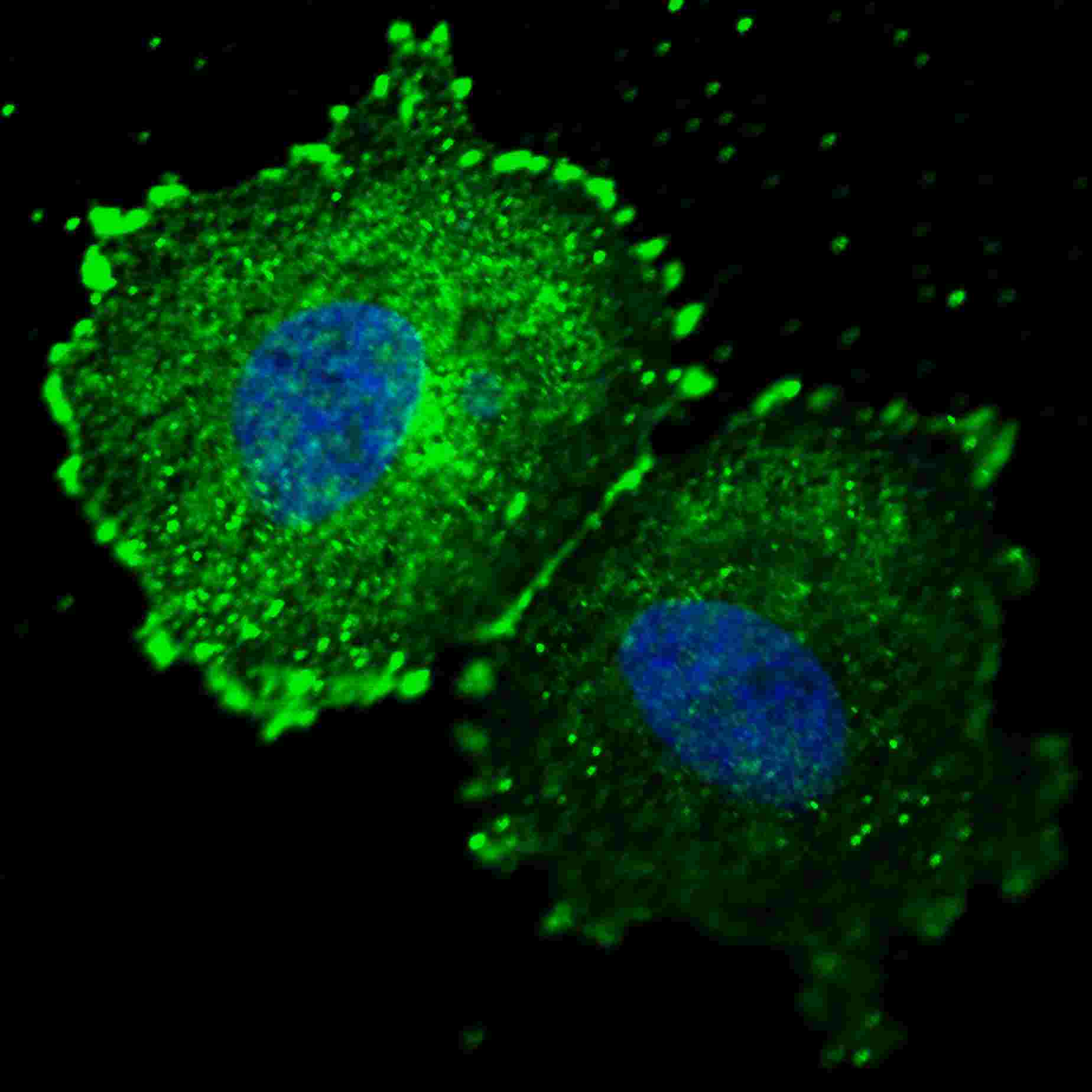 Fluorescent confocal image of MCF7 cells stained with phospho-ERBB2-Y1005 antibody. MCF7 cells were fixed with 4% PFA (20 min), permeabilized with Triton X-100 (0.2%, 30 min).  Cells were then incubated with AP3781s phospho-ERBB2- Y1005 primary antibody (1:100, 2 h at room temperature). For secondary antibody, Alexa Fluor� 488 conjugated donkey anti-rabbit antibody (green) was used (1:1000, 1h). Nuclei were counterstained with Hoechst 33342 (blue) (10 ?g/ml, 5 min). Note the highly specific localization of the phospho-ERBB2-Y1005 to the plasma membrane and cytoplasm.