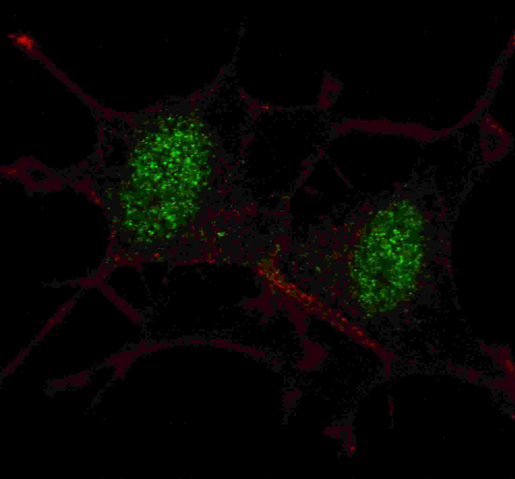 Fluorescent confocal image of SY5Y cells stained with SMAD2 antibody. SY5Y cells were fixed with 4% PFA (20 min), permeabilized with Triton X-100 (0.2%, 30 min). Cells were then incubated with AP7365a SMAD2 primary antibody (1:100, 2 h at room temperature). For secondary antibody, Alexa Fluor� 488 conjugated donkey anti-rabbit antibody (green) was used (1:1000, 1h). Nuclei were counterstained with Hoechst 33342 (blue) (10 ?g/ml, 5 min). Note the highly specific localization of the SMAD2 mainly to the nucleus.