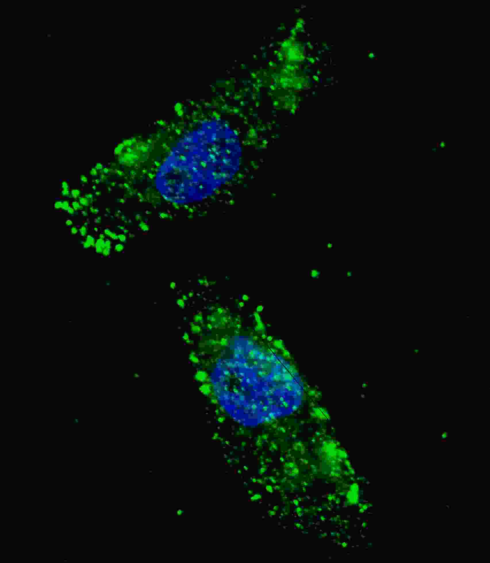 IF - APG1 (ULK1) Antibody (Center) AP8104B