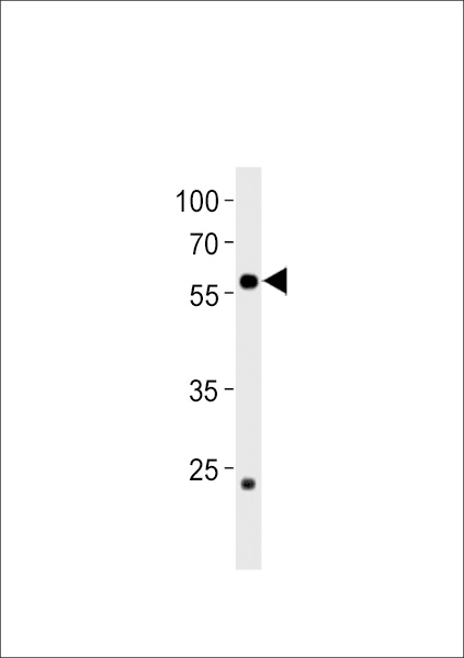 DANRE ccdc149b Antibody (N-term) (Cat. #Azb10009a) western blot analysis in zebra fish heart tissue lysates (35ug/lane).This demonstrates the DANRE ccdc149b antibody detected the DANRE ccdc149b protein (arrow).