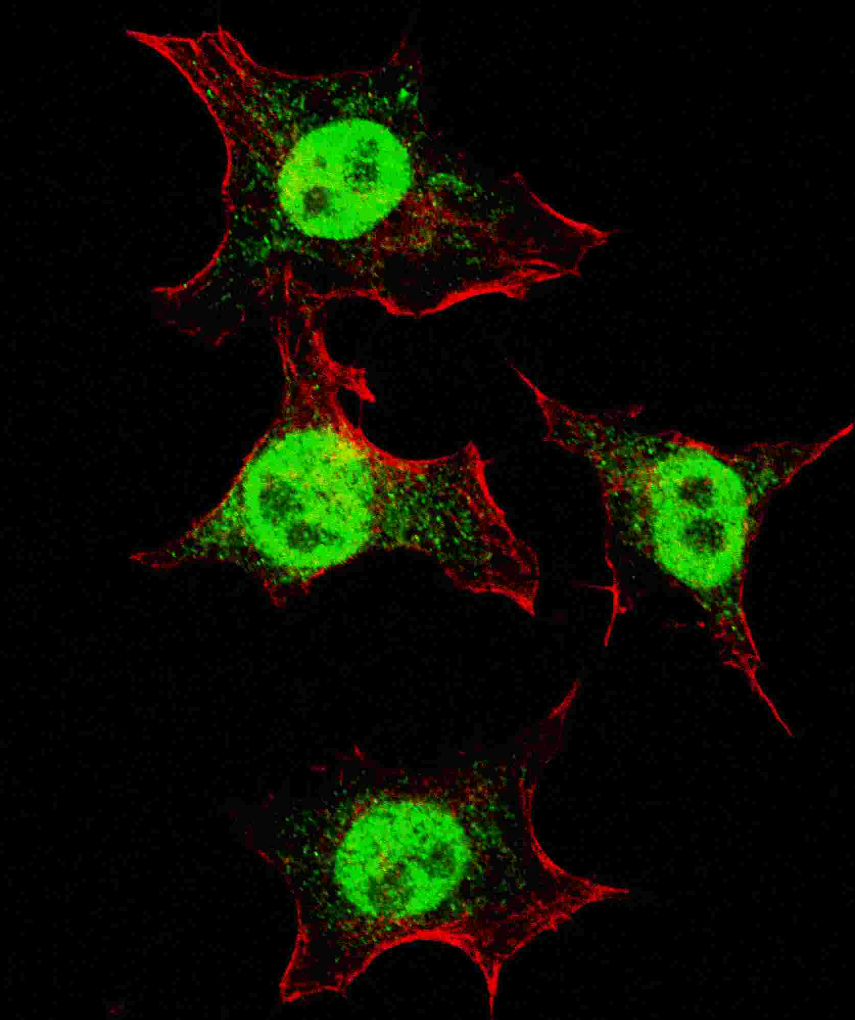 IF - ITGA6 Antibody (isoform 2 S1064) AP2753A