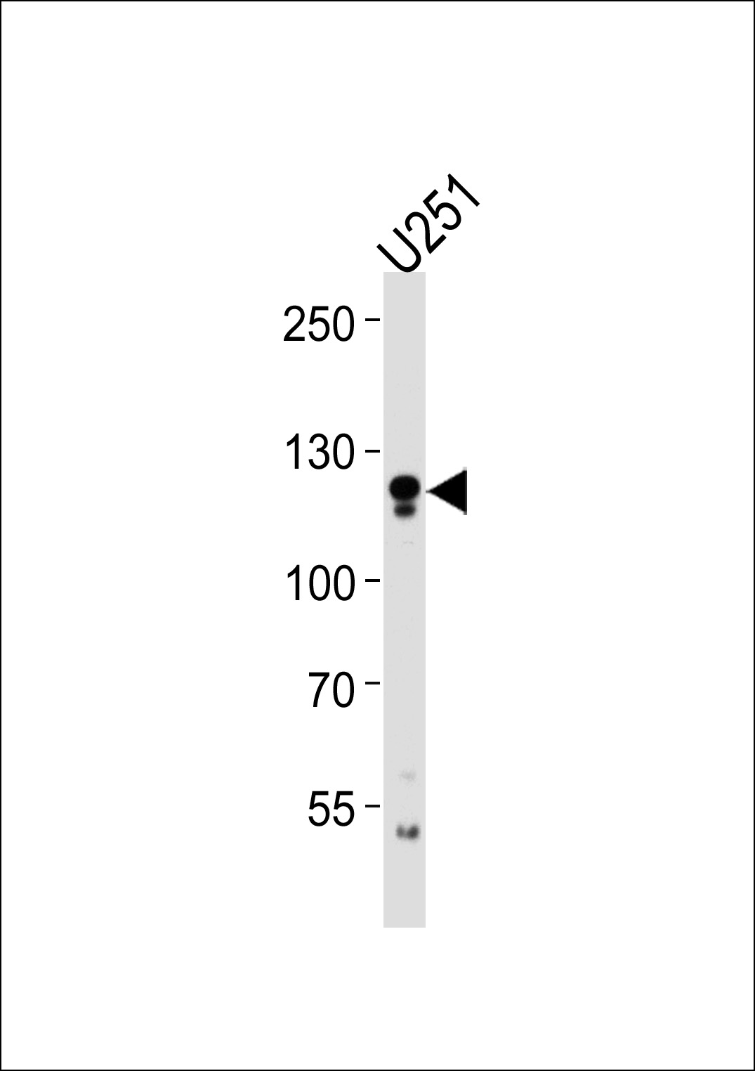 ECE2 Antibody (Center) (Cat. #AP20460c) western blot analysis in U251 cell line lysates (35ug/lane).This demonstrates the ECE2 antibody detected the ECE2 protein (arrow).