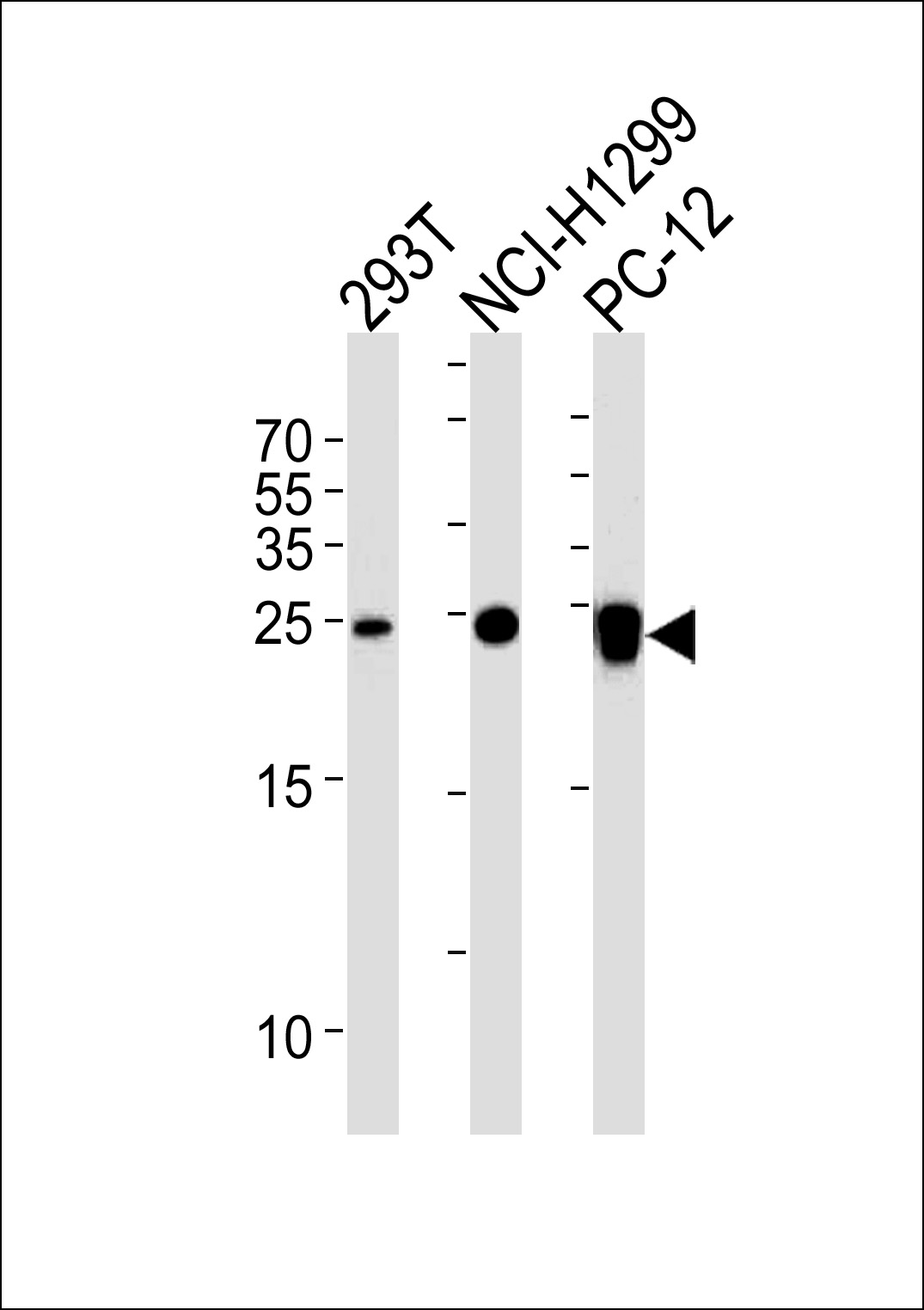 UCHL1 Antibody (C-term)(Cat. #AM2207b) western blot analysis in 293T,NCI-H1299,rat PC-12 cell line lysates (35?g/lane).This demonstrates the UCHL1 antibody detected the UCHL1 protein (arrow).