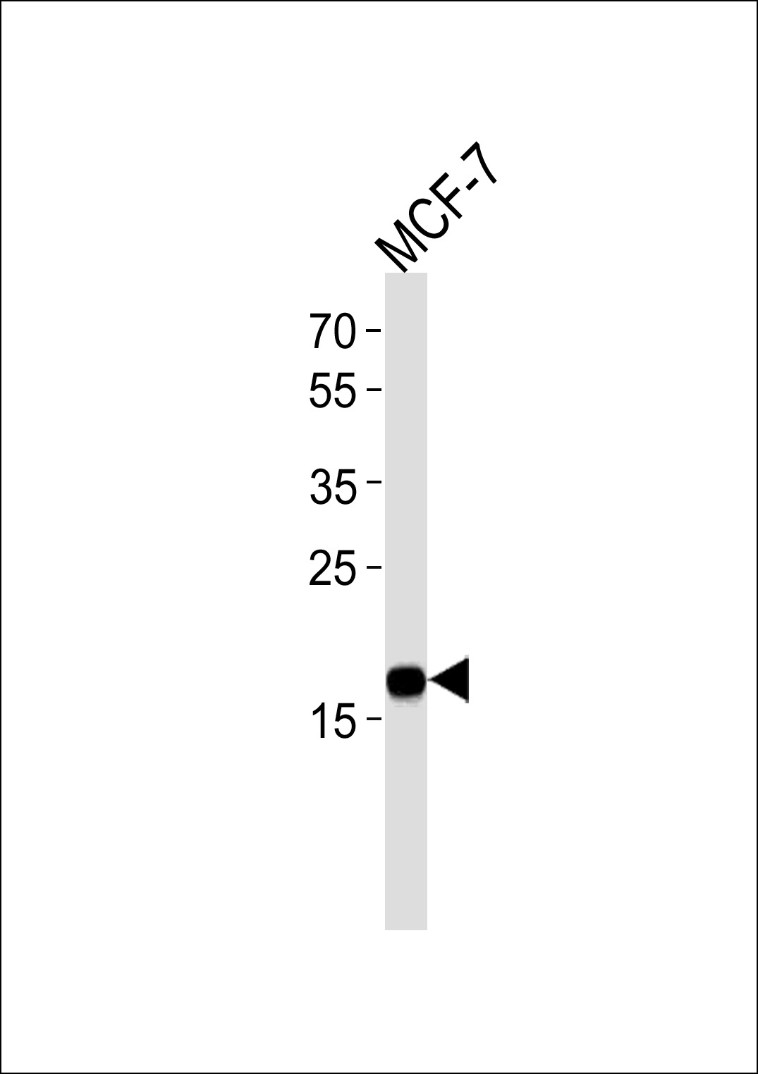 NME1 Antibody(Cat. #AM2209b) western blot analysis in MCF-7 cell line lysates (35?g/lane).This demonstrates the NME1 antibody detected the NME1 protein (arrow).