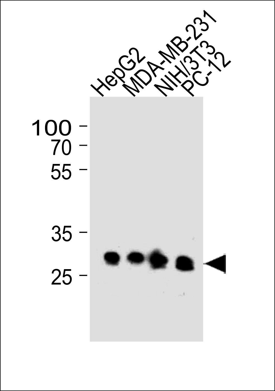 BCL2L1 Antibody(Cat. #AM2211b) western blot analysis in HepG2,MDA-MB-231,mouse NIH/3T3 and rat PC-12 cell line lysates (35?g/lane).This demonstrates the BCL2L1 antibody detected the BCL2L1 protein (arrow).