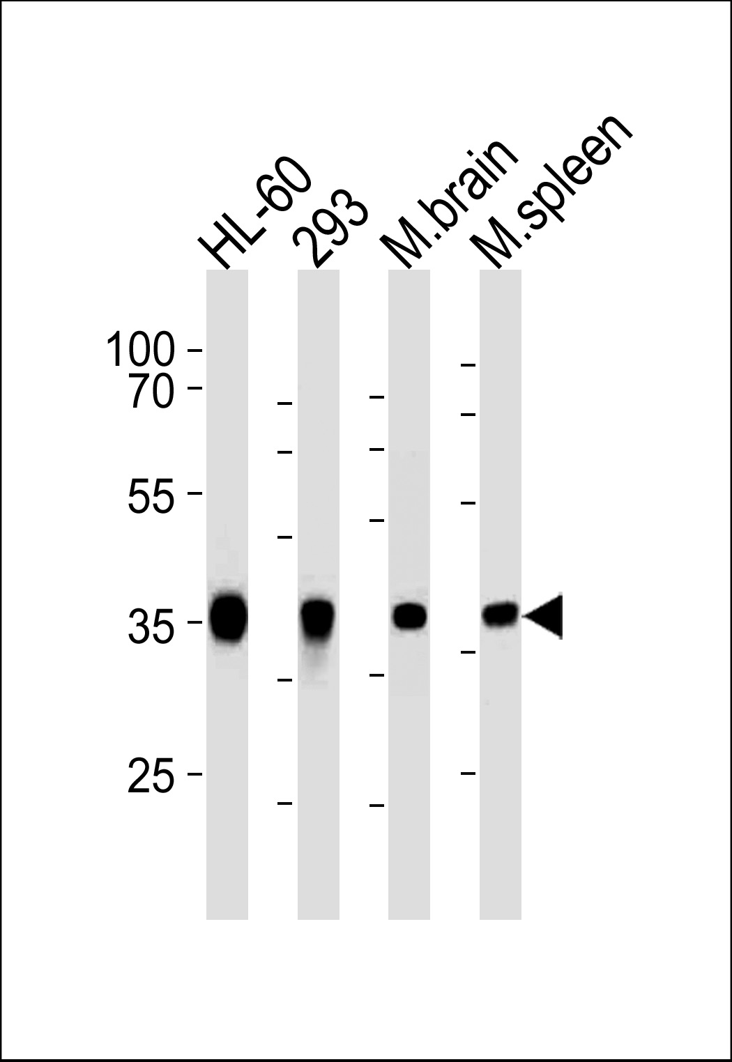 ALDOC Antibody (C-term)(Cat. #AM2215b) western blot analysis in HL-60,293 cell line and mouse brain,spleen lysates (35?g/lane).This demonstrates the ALDOC antibody detected the ALDOC protein (arrow).