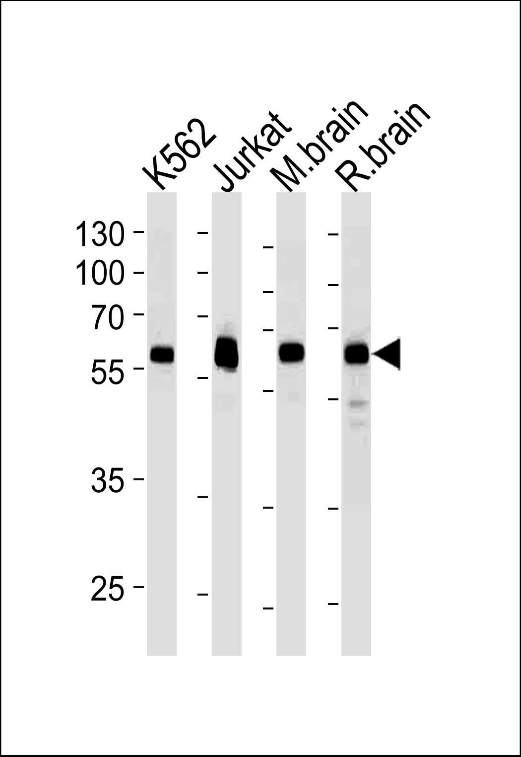 USP14 Antibody (N-term)(Cat. #AM2220b) western blot analysis in k562,Jurkat cell line ,mouse brain and rat brain tissue lysates (35?g/lane).This demonstrates the USP14 antibody detected the USP14 protein (arrow).