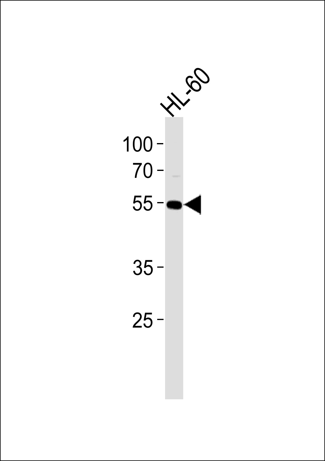 AKT1 Antibody(MS4188) western blot analysis in HL-60 cell line lysates (35?g/lane).This demonstrates the AKT1 antibody detected the AKT1 protein (arrow).